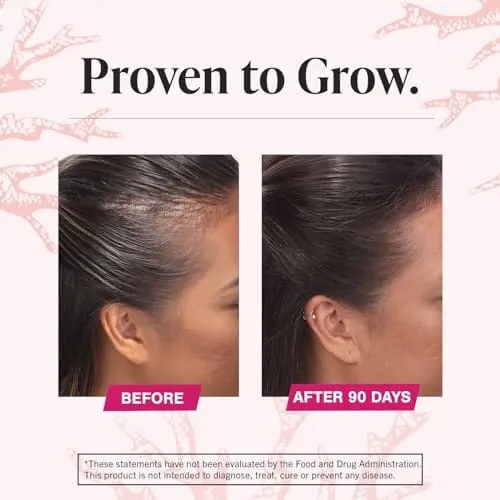 Viviscal Hair Growth Supplements